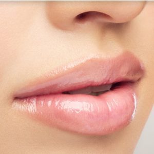 Resultados de aumento de labios con ácido hialurónico en la Clínica Alberto García Valladolid