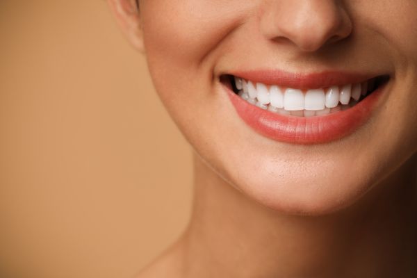 Indicaciones habituales de las carillas dentales en Valladolid