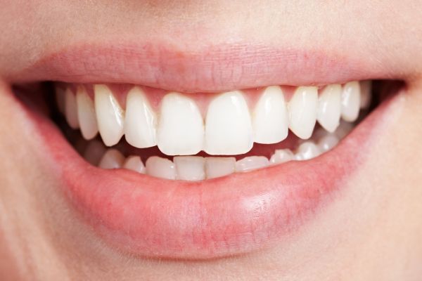 Planificación estética de la sonrisa con herramientas digitales en Valladolid