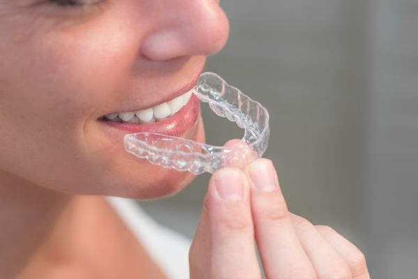 Diferencias entre ortodoncia invisible y brackets en Valladolid