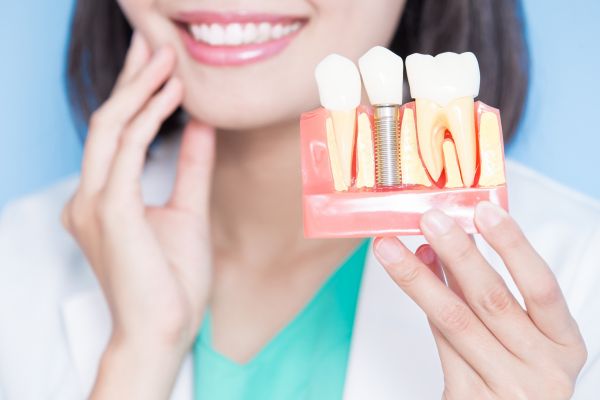 El proceso de colocación de un implante dental paso a paso en Valladolid