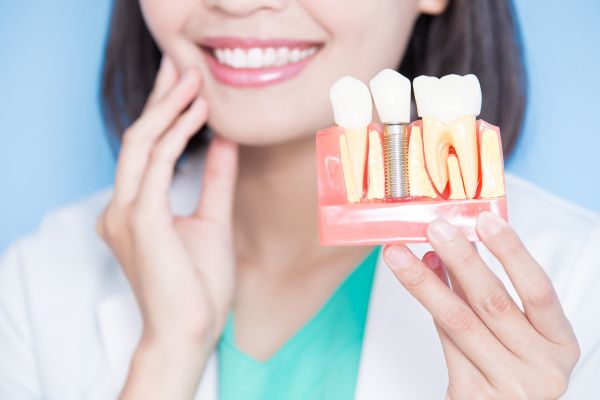Cuidados después de colocar un implante dental en Valladolid